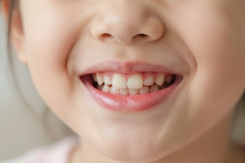 Czerwone dziąsła u dzieci